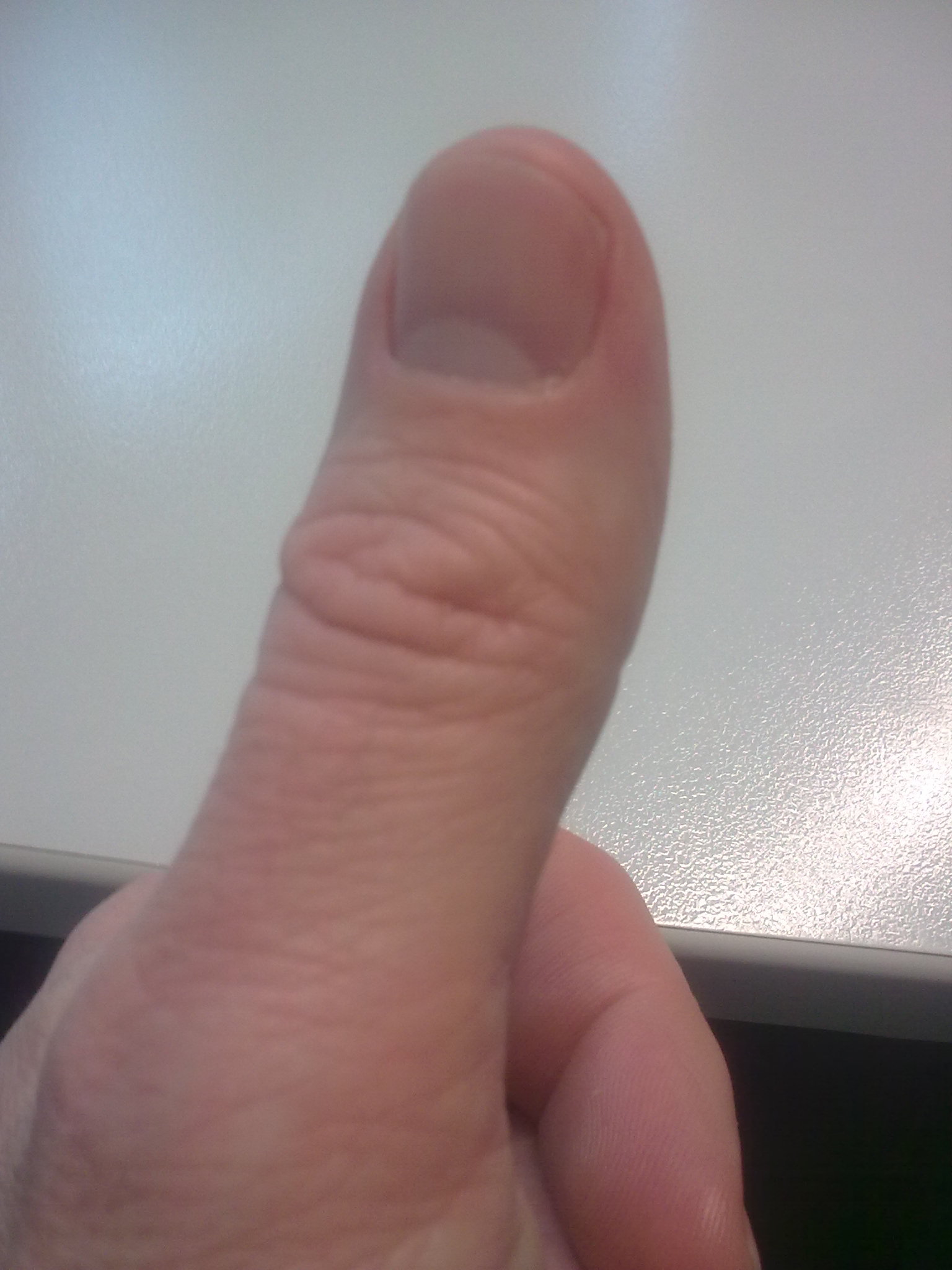 The thumb is the first digit of the hand, next to the index finger. When a person is standing in the medical anatomical position (where the palm is facing to the front), the thumb is the outermost digit. The Medical Latin English noun for thumb is pollex (compare hallux for big toe), and the corresponding adjective for thumb is pollical.


